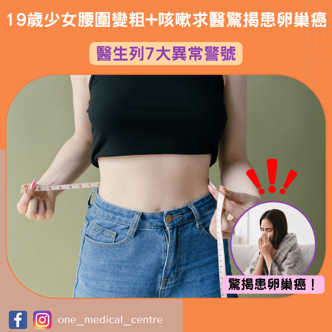 【19歲少女腰圍變粗+咳嗽求醫驚揭患卵巢癌　醫生列7大異常警號】